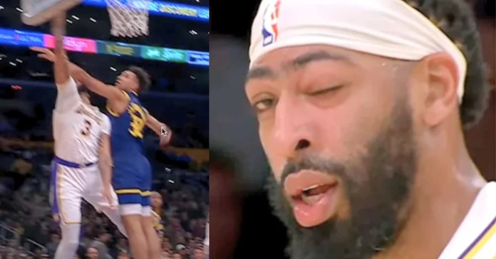 Los Angeles Lakers’ Anthony Davis Sidelined with Eye Injury